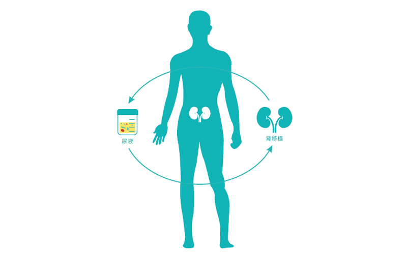 BK病毒相关性肾病（BKVAN）无创检测